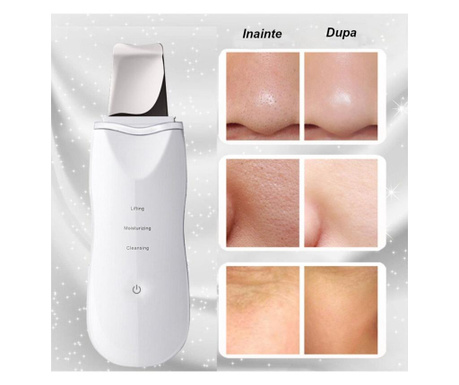 Aparat ultrasonic de curatare faciala si masaj relaxant/antiaging cu ultrasunete, portabil, alb